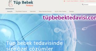 tupbebektedavisi