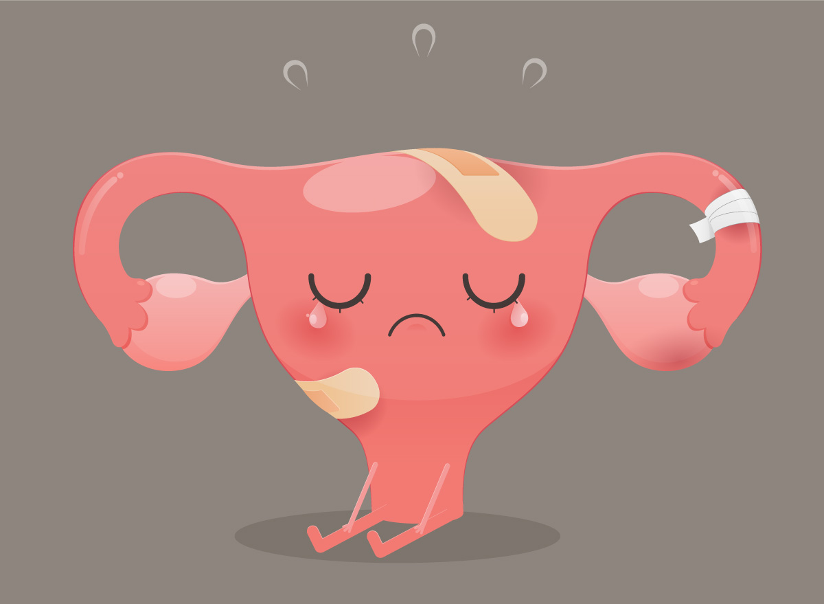 Ovarian Hiperstimülasyon Sendromu (OHSS)