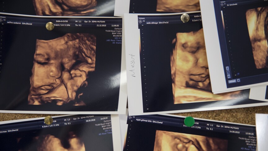 Uzman Uyardı: Annenin Gençliğindeki Mutasyon Bebeğinde Hemofiliye Neden Olabiliyor