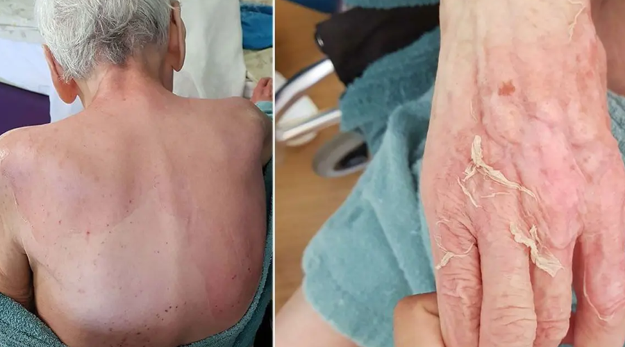 Huzurevinde Banyo Sonrası Hayatını Kaybeden Yaşlı Kadın Davası: Doktora Para Cezası Verildi