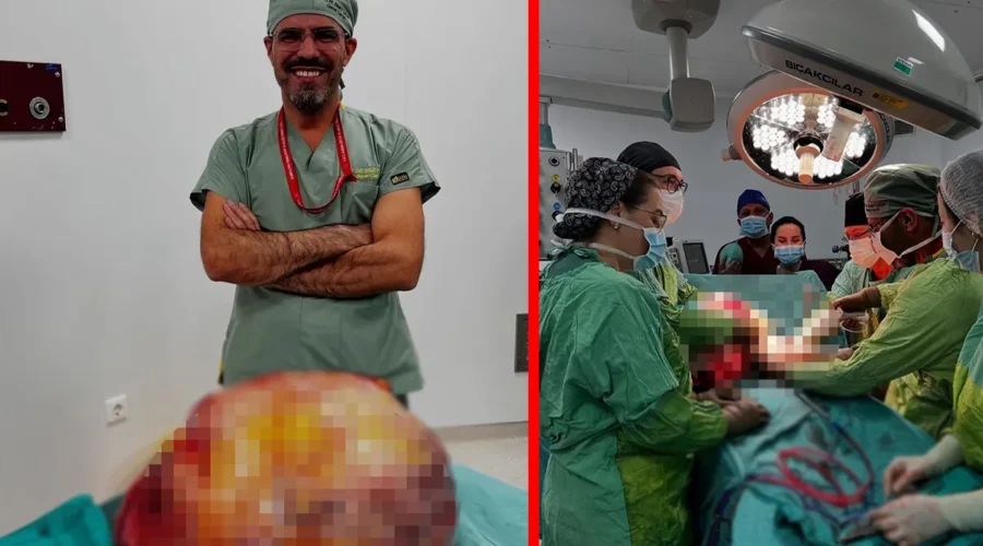 Trabzon’da Ameliyat Rekoru: Cerrah “Meslek Hayatımın En Büyük Tümörünü Çıkardım” Dedi